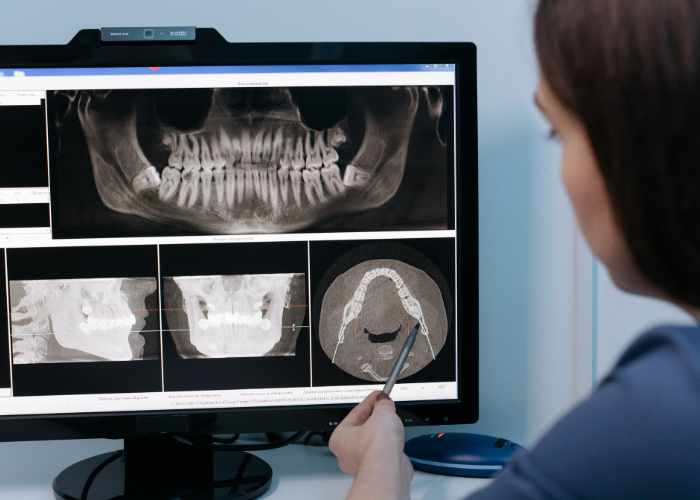 Emergency Dentist Orlando