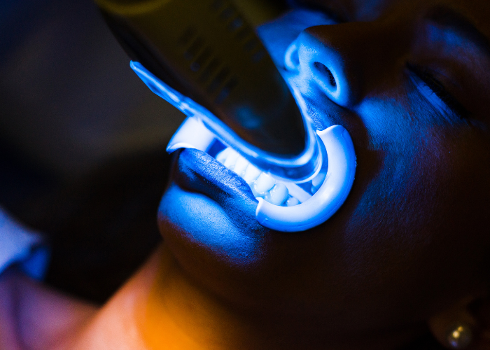 Teeth Whitening Dentist Orlando